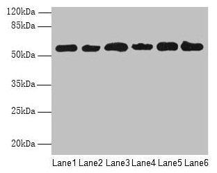 PHF10 Antibody - Western blot All lanes: PHF10 antibody at 8µg/ml Lane 1: Hela whole cell lysate Lane 2: 293T whole cell lysate Lane 3: A2780 whole cell lysate Lane 4: U251 whole cell lysate Lane 5: A549 whole cell lysate Lane 6: A375 whole cell lysate Secondary Goat polyclonal to rabbit IgG at 1/10000 dilution Predicted band size: 57, 56, 52 kDa Observed band size: 57 kDa