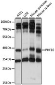 PHF10 Antibody - Western blot analysis of extracts of various cell lines, using PHF10 antibody at 1:1000 dilution. The secondary antibody used was an HRP Goat Anti-Rabbit IgG (H+L) at 1:10000 dilution. Lysates were loaded 25ug per lane and 3% nonfat dry milk in TBST was used for blocking. An ECL Kit was used for detection and the exposure time was 10s.