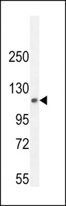 PHF12 Antibody - PHF12 Antibody western blot of mouse lung tissue lysates (35 ug/lane). The PHF12 antibody detected the PHF12 protein (arrow).