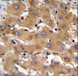 PHF12 Antibody - PHF12 Antibody immunohistochemistry of formalin-fixed and paraffin-embedded human liver tissue followed by peroxidase-conjugated secondary antibody and DAB staining.