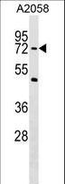 PHF19 Antibody - PHF19 Antibody western blot of A2058 cell line lysates (35 ug/lane). The PHF19 antibody detected the PHF19 protein (arrow).