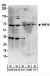 PHF19 Antibody - Detection of Human and Mouse PHF19 by Western Blot. Samples: Whole cell lysate (50 ug) from Jurkat, HeLa, 293T, mouse TCMK-1, and mouse NIH3T3 cells. Antibodies: Affinity purified rabbit anti-PHF19 antibody used for WB at 0.1 ug/ml. Detection: Chemiluminescence with an exposure time of 30 seconds.