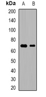 PHF19 Antibody - Western blot analysis of PHF19 expression in mouse brain (A); rat brain (B) whole cell lysates.