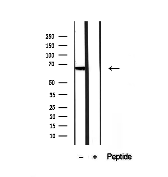 PHF19 Antibody - Western blot analysis of extracts of rat brain tissue using PHF19 antibody.