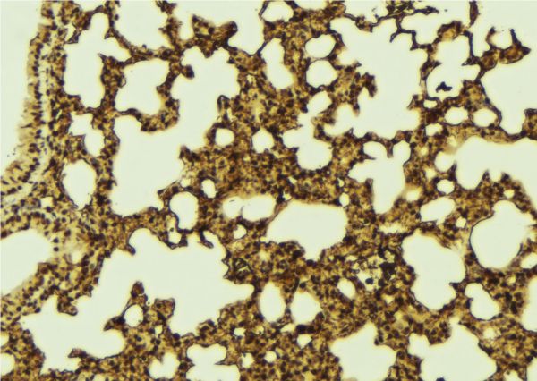 PHF19 Antibody - 1:100 staining mouse lung tissue by IHC-P. The sample was formaldehyde fixed and a heat mediated antigen retrieval step in citrate buffer was performed. The sample was then blocked and incubated with the antibody for 1.5 hours at 22°C. An HRP conjugated goat anti-rabbit antibody was used as the secondary.