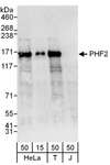 PHF2 Antibody - Detection of Human PHF2 by Western Blot. Samples : Whole cell lysate from HeLa (15 and 50 ug), 293T (T; 50 ug) and Jurkat (J; 50 ug) cells. Antibodies : Affinity purified rabbit anti-PHF2 antibody used for WB at 0.1 ug/ml. Detection: Chemiluminescence with an exposure time of 30 seconds.