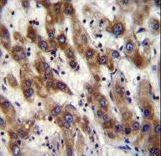 PHF20 Antibody - PHF20 Antibody immunohistochemistry of formalin-fixed and paraffin-embedded human liver tissue followed by peroxidase-conjugated secondary antibody and DAB staining.