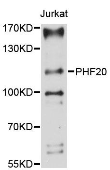 PHF20 Antibody - Western blot analysis of extracts of Jurkat cells.