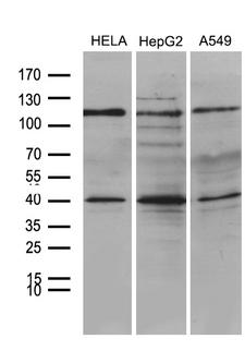 PHF20L1 Antibody - Western blot analysis of extracts. (35ug) from 3 different cell lines by using anti-PHF20L1 monoclonal antibody. (1:500)