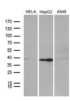 PHF20L1 Antibody - Western blot analysis of extracts. (35ug) from 3 different cell lines by using anti-PHF20L1 monoclonal antibody. (1:500)
