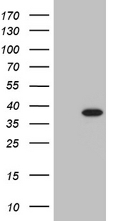 PHF20L1 Antibody - HEK293T cells were transfected with the pCMV6-ENTRY control. (Left lane) or pCMV6-ENTRY PHF20L1. (Right lane) cDNA for 48 hrs and lysed