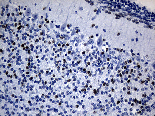 PHF20L1 Antibody - Immunohistochemical staining of paraffin-embedded Human embryonic cerebellum within the normal limits using anti-PHF20L1 mouse monoclonal antibody. (Heat-induced epitope retrieval by 1mM EDTA in 10mM Tris buffer. (pH8.5) at 120 oC for 3 min. (1:500)