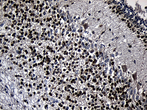 PHF20L1 Antibody - Immunohistochemical staining of paraffin-embedded Human embryonic cerebellum within the normal limits using anti-PHF20L1 mouse monoclonal antibody. (Heat-induced epitope retrieval by 1mM EDTA in 10mM Tris buffer. (pH8.5) at 120 oC for 3 min. (1:500)
