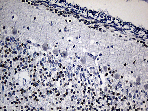 PHF20L1 Antibody - Immunohistochemical staining of paraffin-embedded Human embryonic cerebellum within the normal limits using anti-PHF20L1 mouse monoclonal antibody. (Heat-induced epitope retrieval by 1mM EDTA in 10mM Tris buffer. (pH8.5) at 120 oC for 3 min. (1:150)