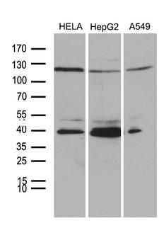 PHF20L1 Antibody - Western blot analysis of extracts. (35ug) from 3 different cell lines by using anti-PHF20L1 monoclonal antibody. (1:500)