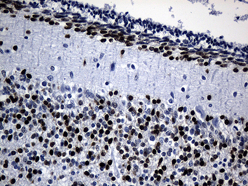 PHF20L1 Antibody - Immunohistochemical staining of paraffin-embedded Human embryonic cerebellum within the normal limits using anti-PHF20L1 mouse monoclonal antibody. (Heat-induced epitope retrieval by 1mM EDTA in 10mM Tris buffer. (pH8.5) at 120 oC for 3 min. (1:500)