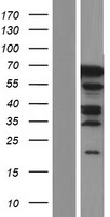 PHF20L1 Protein - Western validation with an anti-DDK antibody * L: Control HEK293 lysate R: Over-expression lysate