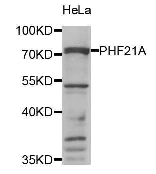 PHF21A / BHC80 Antibody - Western blot analysis of extracts of HeLa cell line, using PHF21A antibody.