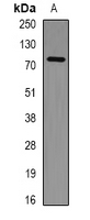 PHF21A / BHC80 Antibody - Western blot analysis of PHF21A expression in HeLa (A) whole cell lysates.