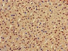 PHF21A / BHC80 Antibody - Immunohistochemistry of paraffin-embedded human adrenal gland tissue at dilution of 1:100
