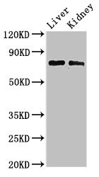 PHF21A / BHC80 Antibody - Western Blot Positive WB detected in:Mouse liver tissue,Mouse kidney tissue All Lanes:PHF21A antibody at 3µg/ml Secondary Goat polyclonal to rabbit IgG at 1/50000 dilution Predicted band size: 75,71 KDa Observed band size: 75 KDa