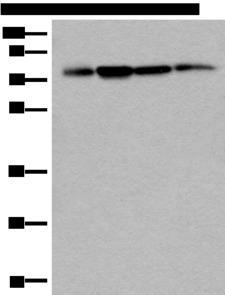 PHF21A / BHC80 Antibody - Western blot analysis of 293T Hela and A375 cell lysates  using PHF21A Polyclonal Antibody at dilution of 1:400
