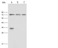 PHF21A / BHC80 Antibody - Anti-PHF21A rabbit polyclonal antibody at 1:500 dilution. Lane A: HeLa Whole Cell Lysate. Lane B: Jurkat Whole Cell Lysate. Lane C: HT1080 Whole Cell Lysate. Lysates/proteins at 30 ug per lane. Secondary: Goat Anti-Rabbit IgG (H+L)/HRP at 1/10000 dilution. Developed using the ECL technique. Performed under reducing conditions. Predicted band size: 75 kDa.