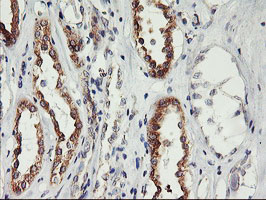 PHF21B Antibody - IHC of paraffin-embedded Human Kidney tissue using anti-PHF21B mouse monoclonal antibody.