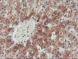 PHF21B Antibody - IHC of paraffin-embedded Human liver tissue using anti-PHF21B mouse monoclonal antibody.