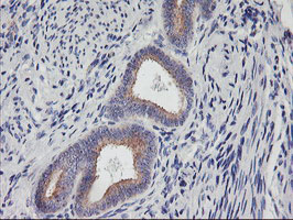 PHF21B Antibody - IHC of paraffin-embedded Human endometrium tissue using anti-PHF21B mouse monoclonal antibody.