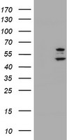 PHF21B Antibody - HEK293T cells were transfected with the pCMV6-ENTRY control (Left lane) or pCMV6-ENTRY PHF21B (Right lane) cDNA for 48 hrs and lysed. Equivalent amounts of cell lysates (5 ug per lane) were separated by SDS-PAGE and immunoblotted with anti-PHF21B.