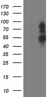 PHF21B Antibody - HEK293T cells were transfected with the pCMV6-ENTRY control (Left lane) or pCMV6-ENTRY PHF21B (Right lane) cDNA for 48 hrs and lysed. Equivalent amounts of cell lysates (5 ug per lane) were separated by SDS-PAGE and immunoblotted with anti-PHF21B.