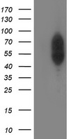 PHF21B Antibody - HEK293T cells were transfected with the pCMV6-ENTRY control (Left lane) or pCMV6-ENTRY PHF21B (Right lane) cDNA for 48 hrs and lysed. Equivalent amounts of cell lysates (5 ug per lane) were separated by SDS-PAGE and immunoblotted with anti-PHF21B.