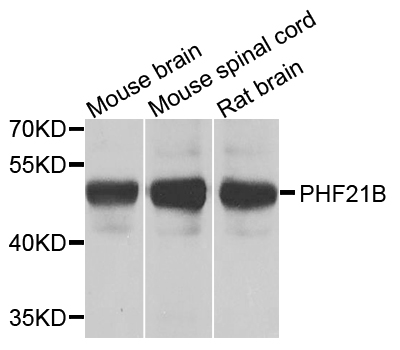 PHF21B Antibody - Western blot analysis of extracts of various cells.