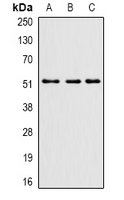 PHF21B Antibody - Western blot analysis of PHF21B expression in mouse brain (A); mouse spinal cord (B); rat brain (C) whole cell lysates.