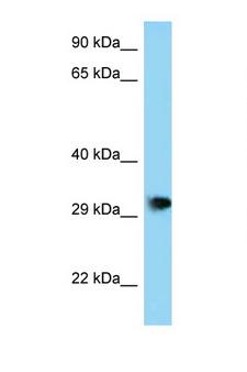 PHF23 Antibody - PHF23 antibody Western blot of Mouse Brain lysate. Antibody concentration 1 ug/ml.  This image was taken for the unconjugated form of this product. Other forms have not been tested.