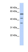 PHF23 Antibody - PHF23 antibody Western blot of MCF7 cell lysate. This image was taken for the unconjugated form of this product. Other forms have not been tested.