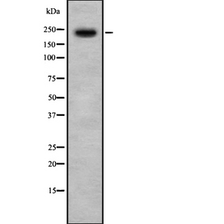 PHF3 Antibody - Western blot analysis of PHF3 using HeLa whole cells lysates
