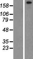 PHF3 Protein - Western validation with an anti-DDK antibody * L: Control HEK293 lysate R: Over-expression lysate
