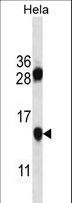PHF5A / INI Antibody - PHF5A Antibody western blot of HeLa cell line lysates (35 ug/lane). The PHF5A antibody detected the PHF5A protein (arrow).