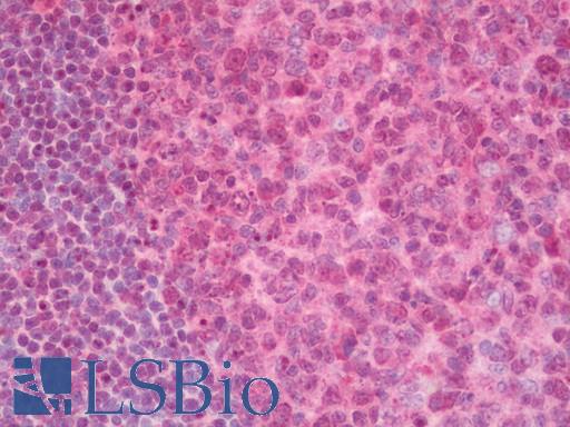 PHF5A / INI Antibody - Human Tonsil: Formalin-Fixed, Paraffin-Embedded (FFPE).  This image was taken for the unconjugated form of this product. Other forms have not been tested.