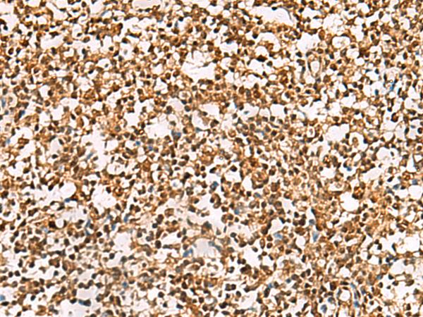 PHF5A / INI Antibody - Immunohistochemistry of paraffin-embedded Human tonsil tissue  using PHF5A Polyclonal Antibody at dilution of 1:55(×200)