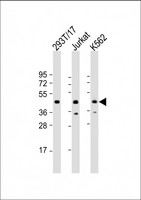 PHF6 Antibody - All lanes: Anti-PHF6 Antibody (Center) at 1:2000 dilution. Lane 1: 293T/17 whole cell lysate. Lane 2: Jurkat whole cell lysate. Lane 3: K562 whole cell lysate Lysates/proteins at 20 ug per lane. Secondary Goat Anti-Rabbit IgG, (H+L), Peroxidase conjugated at 1:10000 dilution. Predicted band size: 41 kDa. Blocking/Dilution buffer: 5% NFDM/TBST.