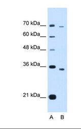 PHF6 Antibody - Lane A: Marker. Lane B: HepG2 cell lysate. Antibody concentration: 1.25 ug/ml. Gel concentration: 12%.  This image was taken for the unconjugated form of this product. Other forms have not been tested.