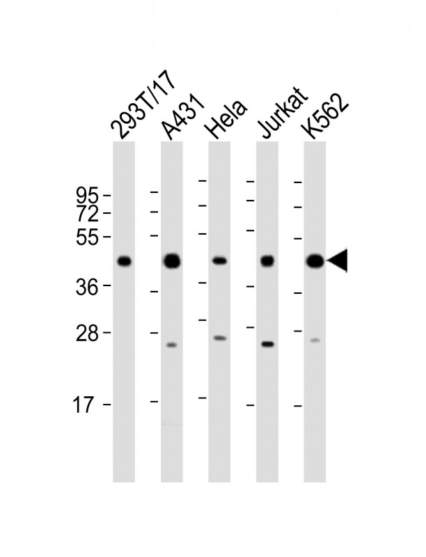 PHF6 Antibody - All lanes: Anti-PHF6 Antibody (C-Term) at 1:2000 dilution. Lane 1: 293T/17 whole cell lysate. Lane 2: A431 whole cell lysate. Lane 3: HeLa whole cell lysate. Lane 4: Jurkat whole cell lysate. Lane 5: K562 whole cell lysate Lysates/proteins at 20 ug per lane. Secondary Goat Anti-Rabbit IgG, (H+L), Peroxidase conjugated at 1:10000 dilution. Predicted band size: 41 kDa. Blocking/Dilution buffer: 5% NFDM/TBST.