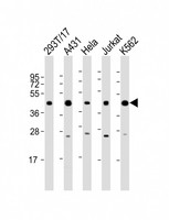 PHF6 Antibody - All lanes: Anti-PHF6 Antibody (C-Term) at 1:2000 dilution. Lane 1: 293T/17 whole cell lysate. Lane 2: A431 whole cell lysate. Lane 3: HeLa whole cell lysate. Lane 4: Jurkat whole cell lysate. Lane 5: K562 whole cell lysate Lysates/proteins at 20 ug per lane. Secondary Goat Anti-Rabbit IgG, (H+L), Peroxidase conjugated at 1:10000 dilution. Predicted band size: 41 kDa. Blocking/Dilution buffer: 5% NFDM/TBST.