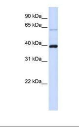 PHF6 Antibody - Fetal brain lysate. Antibody concentration: 1.0 ug/ml. Gel concentration: 12%.  This image was taken for the unconjugated form of this product. Other forms have not been tested.