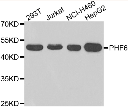 PHF6 Antibody - Western blot analysis of extracts of various cell lines.