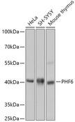 PHF6 Antibody - Western blot analysis of extracts of various cell lines using PHF6 Polyclonal Antibody at dilution of 1:1000.