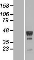 PHF6 Protein - Western validation with an anti-DDK antibody * L: Control HEK293 lysate R: Over-expression lysate